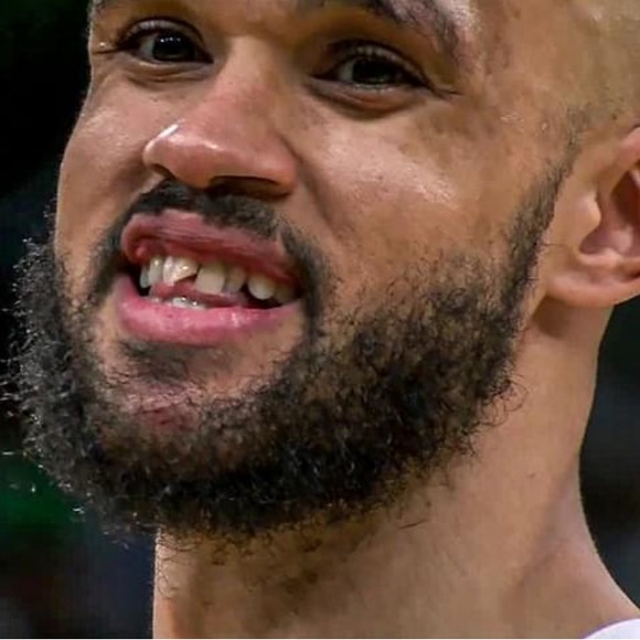 Meet your Posher, Shad - Picture 1 of 1